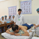 Châm cứu – nét độc đáo của y học cổ truyền