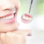 Bác sĩ nha khoa: Đào tạo ít, nhu cầu nhiều