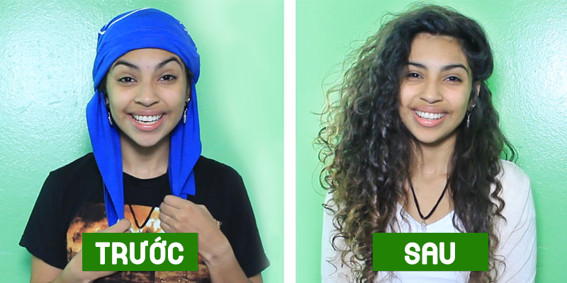 Trước và sau khi thực hiện phương pháp Plopping